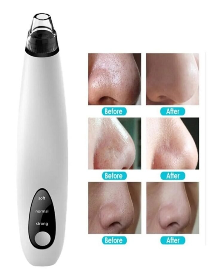 Electric Blackhead Remover Cleaner Face Diamond Pore Vacuum Suction White Heads - Image 4