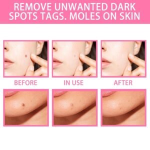 Organic Tags Solutions Serum No Trace Painle Skin Tag Remover Serum Mole Removal Cream Painless Face Wart Mole Freckle