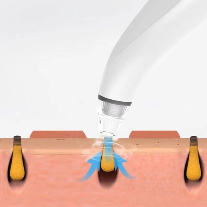 Electric Blackhead Remover Cleaner Face Diamond Pore Vacuum Suction White Heads - Image 2