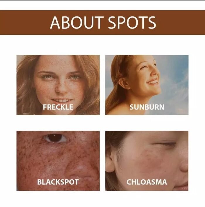 Anti Freckle Serum - Image 2